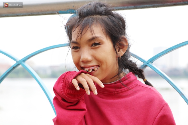 Bé gái bị teo não theo cha đi lượm ve chai ở bờ sông Sài Gòn: "Ngồi chờ ba xíu, lát ba quay lại cõng con lên ghe nghen"