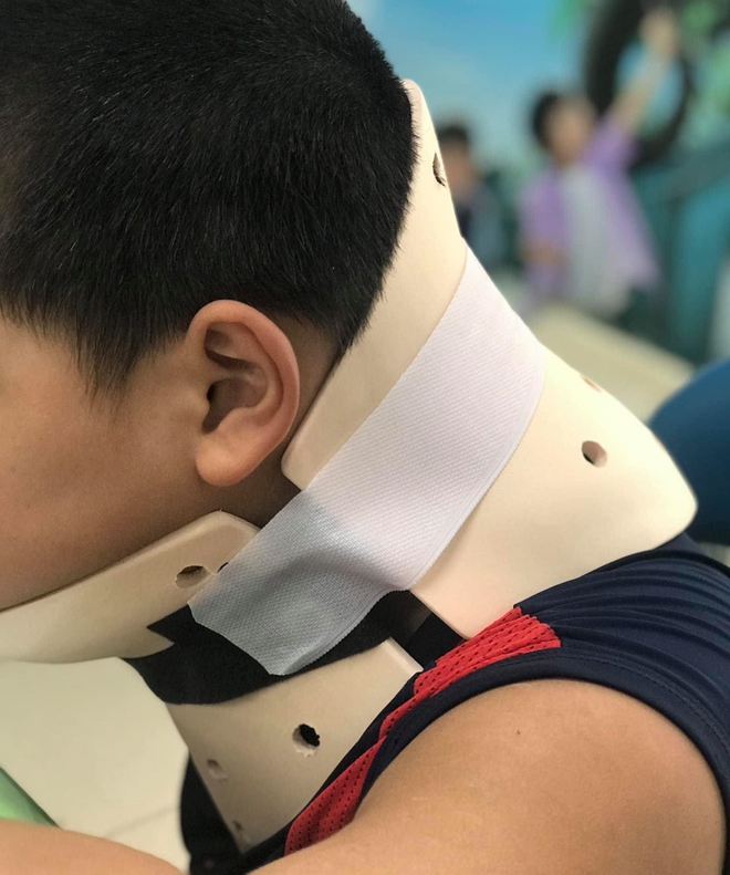 TP.HCM: Bắt chước trò chơi nhào lộn trên TikTok, bé trai 10 tuổi ngã vẹo cổ, đầu bị nghiêng sang một bên - Ảnh 1.