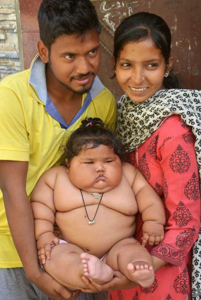 &quot;Bé gái béo nhất thế giới&quot; 8 tháng tuổi đã nặng gần 20kg, từng khiến truyền thông thế giới phải ngỡ ngàng 3 năm trước giờ ra sao? - Ảnh 4.