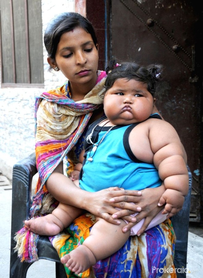 &quot;Bé gái béo nhất thế giới&quot; 8 tháng tuổi đã nặng gần 20kg, từng khiến truyền thông thế giới phải ngỡ ngàng 3 năm trước giờ ra sao? - Ảnh 4.