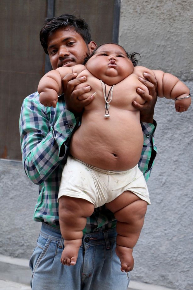&quot;Bé gái béo nhất thế giới&quot; 8 tháng tuổi đã nặng gần 20kg, từng khiến truyền thông thế giới phải ngỡ ngàng 3 năm trước giờ ra sao? - Ảnh 6.