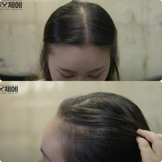 Hairstylist người Hàn bày cách cứu rỗi mái tóc mỏng dính, hói cả mảng: Chị em tự làm ở nhà ngon ơ mà chẳng cần ra tiệm - Ảnh 1.