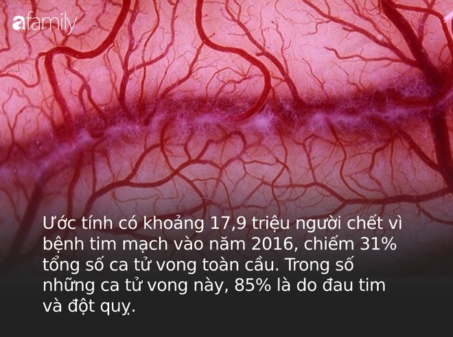 Không phải ung thư, WHO cảnh báo đây mới là căn bệnh gây tử vong số 1 toàn cầu, 80% có thể ngăn chặn nếu thực hiện 4 thói quen tốt - Ảnh 1.