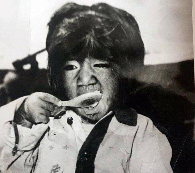 “Cậu bé người vượn” sinh ra toàn thân phủ đầy lông bị gia đình ghét bỏ vì xấu xí gây bất ngờ với cuộc sống hiện tại bên bạn gái xinh đẹp - Ảnh 3.