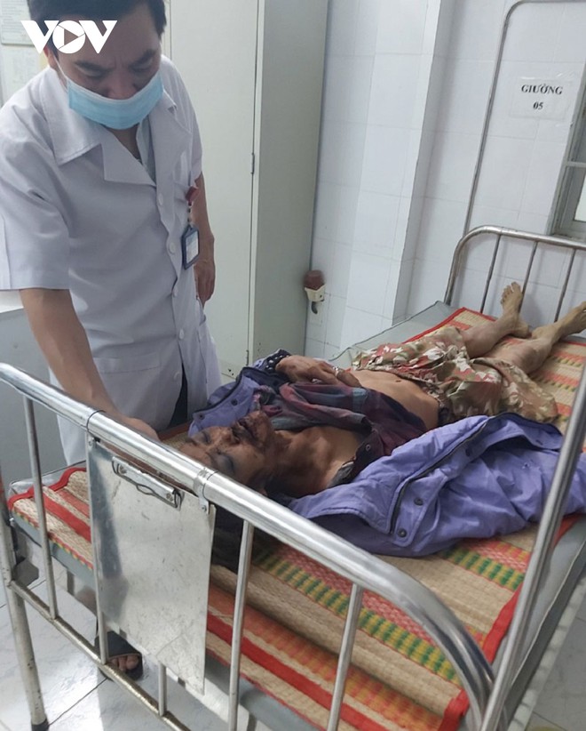 V&agrave;o rừng, một người d&acirc;n&nbsp;bị voi tấn c&ocirc;ng chấn thương sọ n&atilde;o - Ảnh 3.