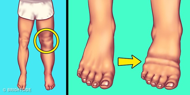3 biểu hiện khi thức dậy vào buổi sáng ngầm cảnh báo thận đang hoạt động bất ổn, xem thử bạn có cái nào không - Ảnh 3. 3 biểu hiện khi thức dậy vào buổi sáng ngầm cảnh báo thận đang hoạt động bất ổn, xem thử bạn có cái nào không - Ảnh 3.