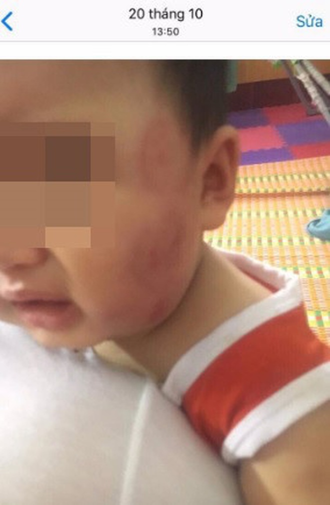Vụ bé gái 2 tuổi bị bạn học đánh đạp dã man: Lãnh đạo xã khẳng định sẽ đóng cửa cơ sở nếu có sai phạm, chia sẻ về tình hình hiện tại của cháu bé - Ảnh 2. Vụ bé gái 2 tuổi bị bạn học đánh đạp dã man: Lãnh đạo xã khẳng định sẽ đóng cửa cơ sở nếu có sai phạm, chia sẻ về tình hình hiện tại của cháu bé - Ảnh 2.