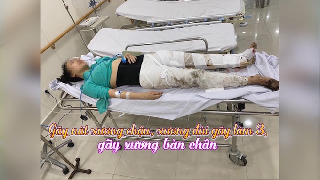 Cuộc sống nữ tiếp vi&ecirc;n h&agrave;ng kh&ocirc;ng sau tai nạn Mercedes tốc độ 84 km/h t&ocirc;ng tr&uacute;ng giờ ra sao? - Ảnh 3.