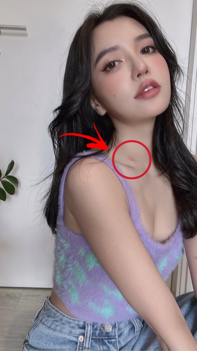 Bích Phương trượt tay để lộ dấu vết lạ trên cổ, netizen tranh cãi liệu có phải hickey? - Ảnh 2.