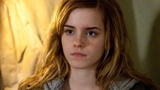 5 diễn viên chính coi Harry Potter như ác mộng, suýt ngừng đóng: Emma Watson gặp nguy hiểm, nam chính mắc 1 vấn đề trầm trọng! - Ảnh 3.