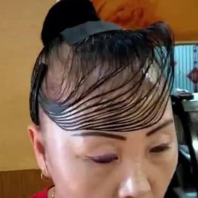 Người phụ nữ tốn gần 200 trăm triệu cấy tóc, netizen nhìn tác phẩm mà muốn lả đi - Ảnh 4.