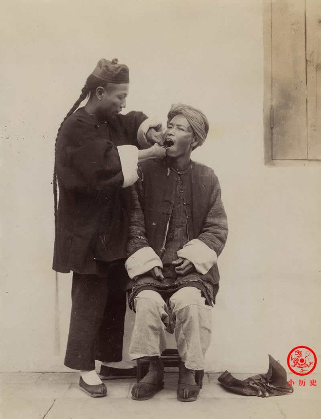 Bộ ảnh phản ánh xã hội cuối thời nhà Thanh: Nhìn nha sĩ dùng dụng cụ thô sơ nhổ răng cho bệnh nhân mà ngỡ ngàng - Ảnh 9.