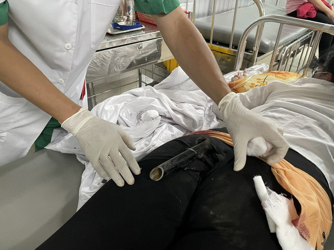 Va chạm giao th&ocirc;ng, c&ocirc; g&aacute;i bị ch&acirc;n chống xe m&aacute;y đ&acirc;m thẳng v&agrave;o m&ocirc;ng - Ảnh 1.