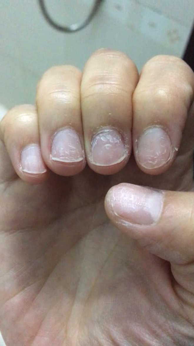 Trước Tết thi nhau khoe nail sang chảnh, ra Tết lại kể "khổ" vì móng nham nhở như chuột gặm: Ai làm nail cũng chịu trận cảnh này thôi! - Ảnh 5.