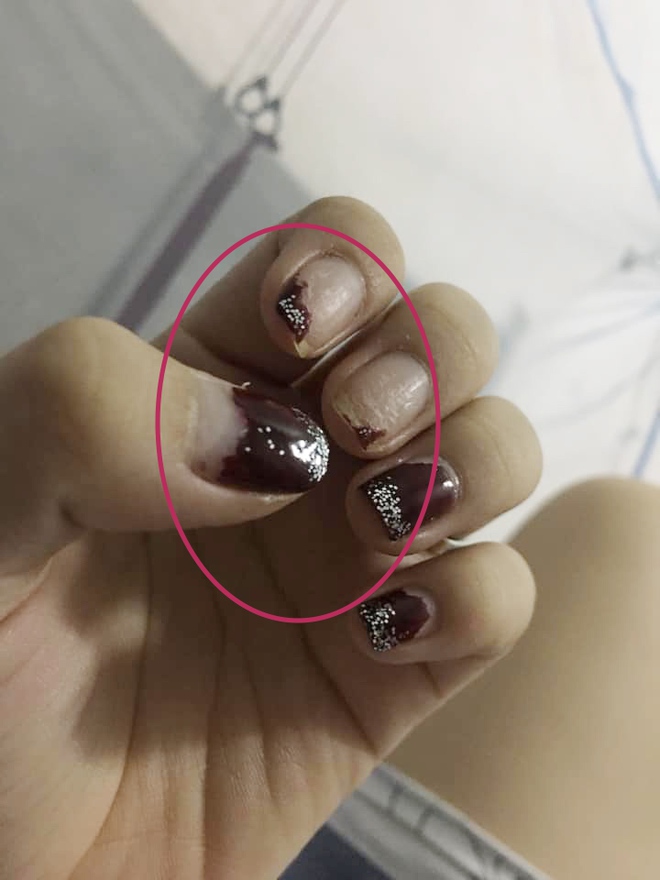 Trước Tết thi nhau khoe nail sang chảnh, ra Tết lại kể "khổ" vì móng nham nhở như chuột gặm: Ai làm nail cũng chịu trận cảnh này thôi! - Ảnh 2.