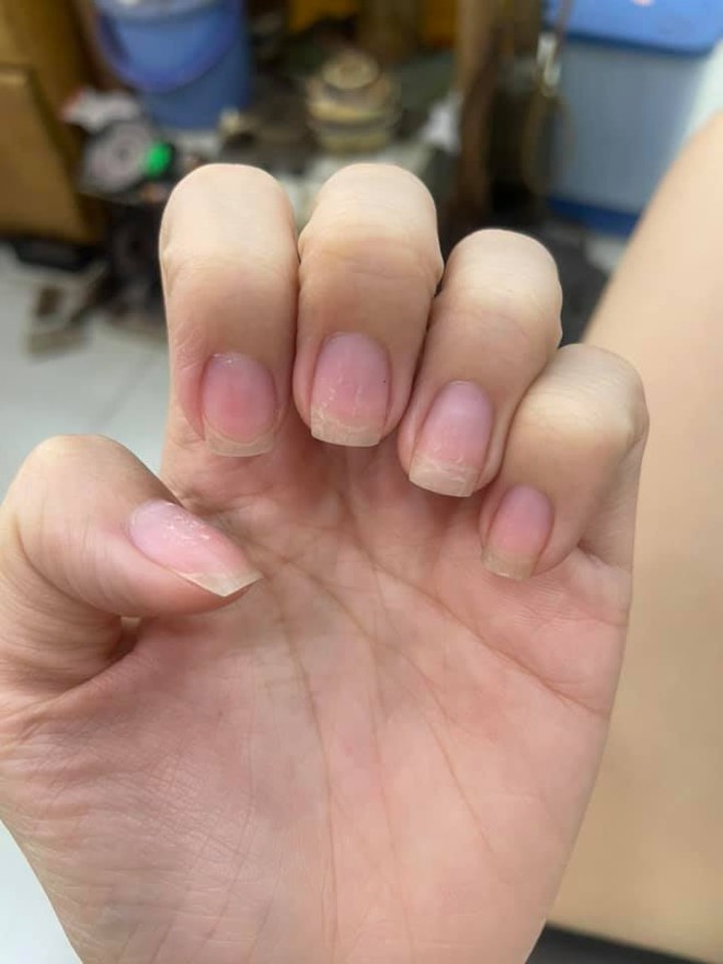 Trước Tết thi nhau khoe nail sang chảnh, ra Tết lại kể "khổ" vì móng nham nhở như chuột gặm: Ai làm nail cũng chịu trận cảnh này thôi! - Ảnh 5.