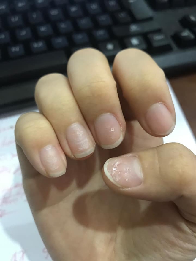 Trước Tết thi nhau khoe nail sang chảnh, ra Tết lại kể "khổ" vì móng nham nhở như chuột gặm: Ai làm nail cũng chịu trận cảnh này thôi! - Ảnh 5.