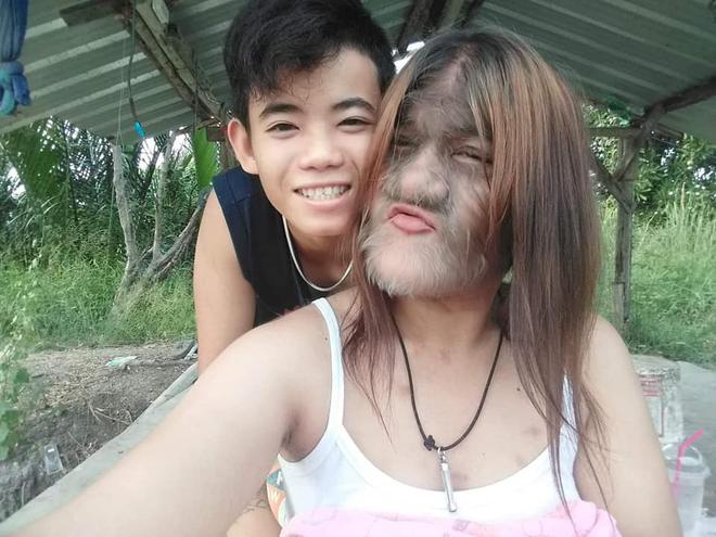 C&ocirc; b&eacute; &ldquo;người s&oacute;i&rdquo; từng nổi tiếng thế giới v&igrave; to&agrave;n th&acirc;n phủ đầy l&ocirc;ng g&acirc;y bất ngờ với diện mạo hiện tại v&agrave; cuộc sống hạnh ph&uacute;c b&ecirc;n bạn trai - Ảnh 6.