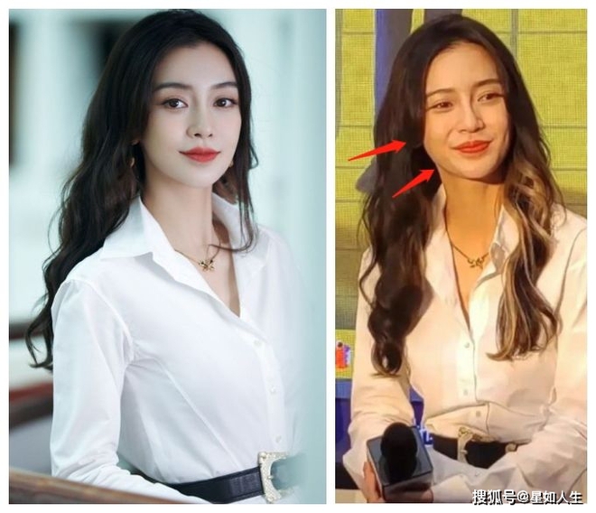 Nhan sắc Angela Baby ngày càng xuống cấp nghiêm trọng, liên tục phải tiêm mặt vì bác sĩ thẩm mỹ... nghỉ hưu? - Ảnh 4.