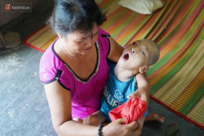 3 đứa trẻ bệnh tật, đói ăn trong căn chòi rách nát: "Mấy bạn nói nhà con nghèo, có anh trai bại não nên không được chơi chung" - Ảnh 4. 3 đứa trẻ bệnh tật, đói ăn trong căn chòi rách nát: "Mấy bạn nói nhà con nghèo, có anh trai bại não nên không được chơi chung" - Ảnh 4.