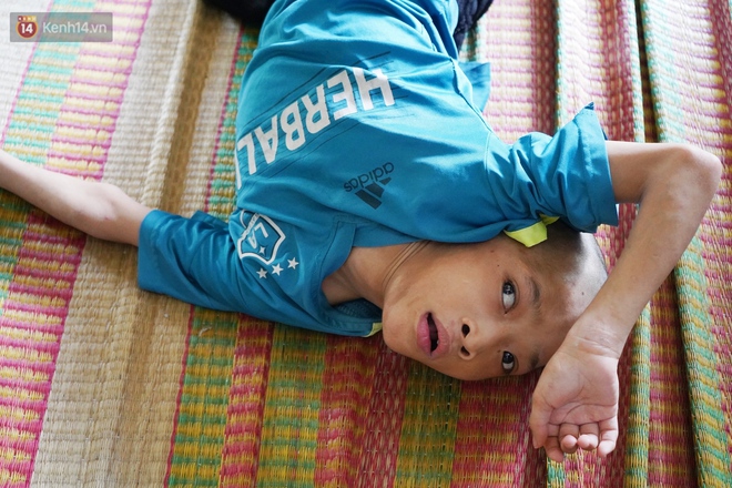 3 đứa trẻ bệnh tật, đói ăn trong căn chòi rách nát: "Mấy bạn nói nhà con nghèo, có anh trai bại não nên không được chơi chung" - Ảnh 8. 3 đứa trẻ bệnh tật, đói ăn trong căn chòi rách nát: "Mấy bạn nói nhà con nghèo, có anh trai bại não nên không được chơi chung" - Ảnh 8.