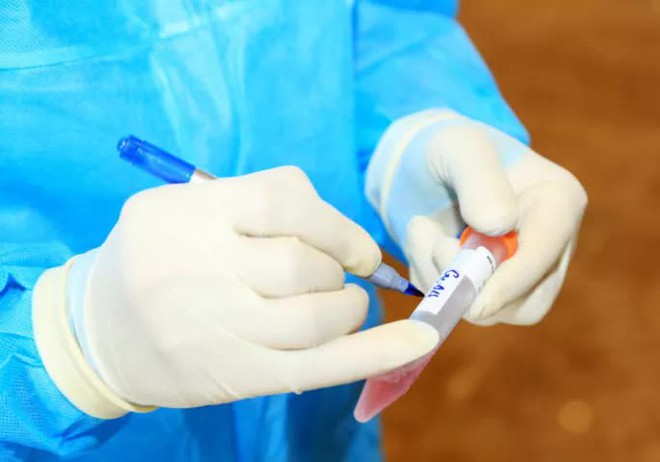 Nam thanh ni&ecirc;n dương t&iacute;nh SARS-CoV-2 sau khi từ Bắc Giang về qu&ecirc; Thanh H&oacute;a - Ảnh 1.