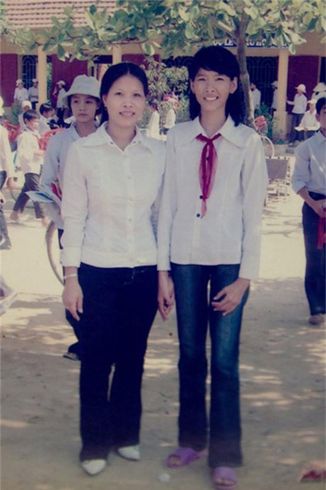 Hoàng Thuỳ và hành trình lột xác nhìn phát choáng: Gái quê cao kều, đen nhẻm hoá Á hậu body nảy nở, bị nghi dao kéo vòng 1 - Ảnh 3. Hoàng Thuỳ và hành trình lột xác nhìn phát choáng: Gái quê cao kều, đen nhẻm hoá Á hậu body nảy nở, bị nghi dao kéo vòng 1 - Ảnh 3.