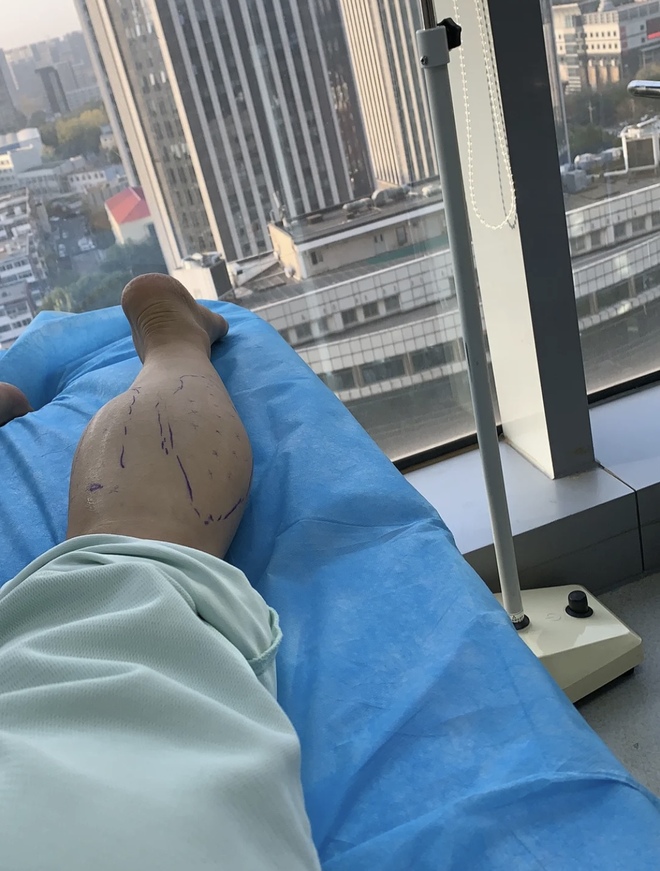 Đôi chân trong truyện tranh: Trào lưu phẫu thuật thẩm mỹ cắt bỏ dây thần kinh để sở hữu bắp chân thon gọn của các cô nàng Trung Quốc - Ảnh 6.