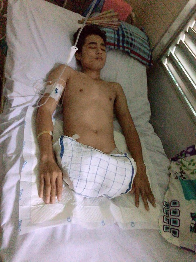 Nghị lực phi thường của chàng trai phải cưa cụt đôi chân ở tuổi 25 và hành trình trao yêu thương giữa dịch Covid-19 - Ảnh 3.