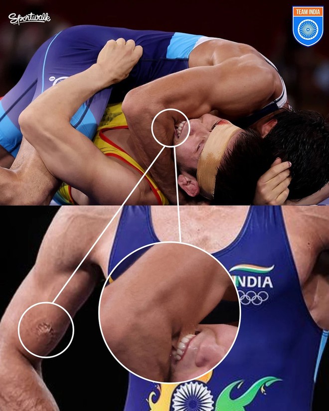 Khoảnh khắc xấu x&iacute; nhất Olympic: Đ&ocirc; vật cắn người, dấu răng hằn tr&ecirc;n tay đối thủ nhưng luật hoa quả kh&ocirc;ng chừa một ai - Ảnh 1.