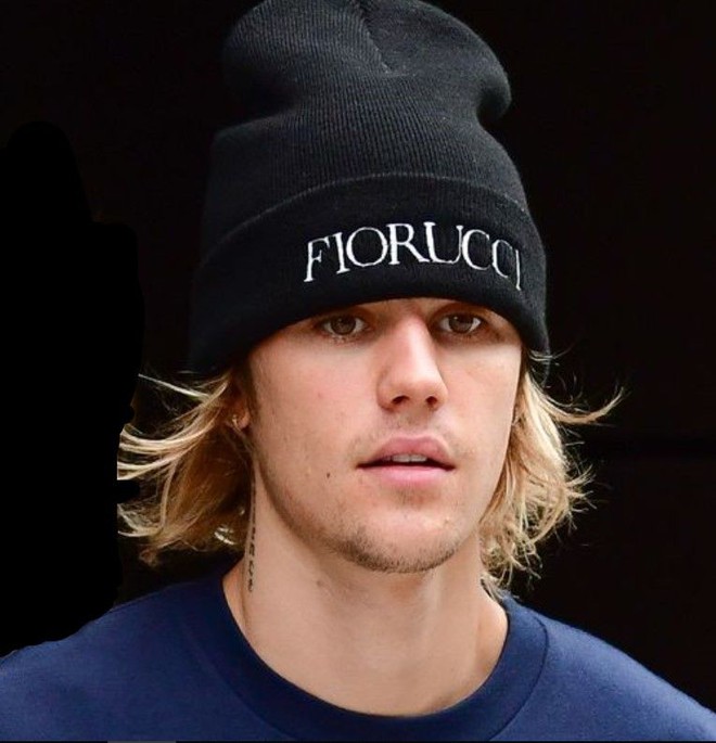 Justin Bieber h&eacute; lộ l&yacute; do xuống sắc kh&ocirc;ng phanh gần đ&acirc;y: Mắc bệnh hiếm gặp ảnh hưởng đến n&atilde;o! - Ảnh 3.