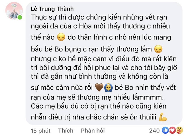 Không chỉ rạn chi chít bụng, Hoà Minzy còn rụng hết tóc, Đức Phúc - Erik phản ứng thế nào khi trực tiếp chứng kiến? - Ảnh 2.