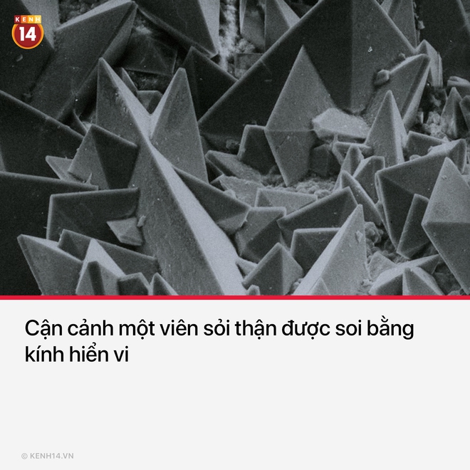 17 bức hình hiếm hoi giúp bạn có thêm góc nhìn mới mẻ về nhiều thứ thân quen trong cuộc sống - Ảnh 5. 17 bức hình hiếm hoi giúp bạn có thêm góc nhìn mới mẻ về nhiều thứ thân quen trong cuộc sống - Ảnh 5.