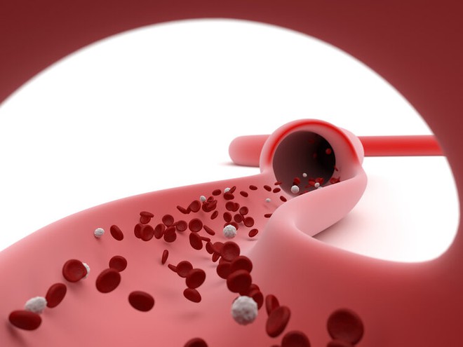 Nhật Bản c&oacute; tỉ lệ bị đột quỵ, mắc bệnh tim mạch thấp nhất thế giới: 4 th&oacute;i quen của người Nhật rất đ&aacute;ng học hỏi, người Việt lại thường bỏ qua - Ảnh 1.