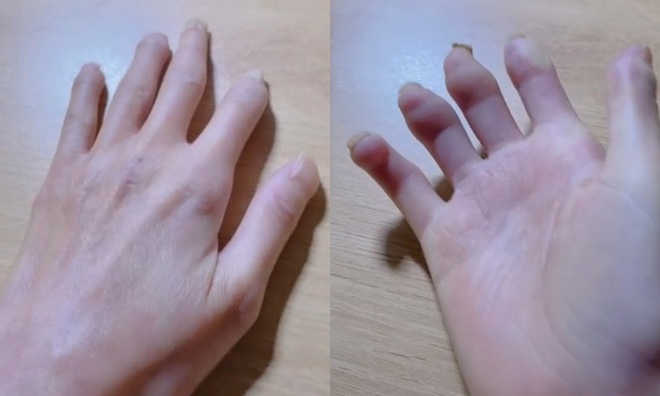 C&ocirc; gi&aacute;o mầm non mắc bệnh hiếm khiến nhan sắc biến đổi: Clip 15 gi&acirc;y g&acirc;y b&atilde;o MXH - Ảnh 4.