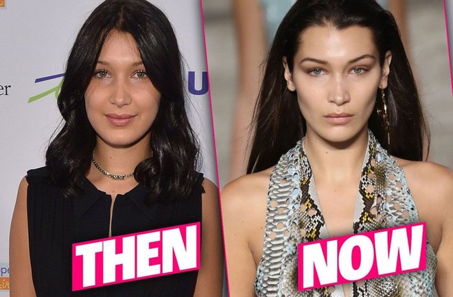 Chuyên gia thẩm mỹ khẳng định: Bella Hadid có gương mặt đẹp nhất - Ảnh 6.