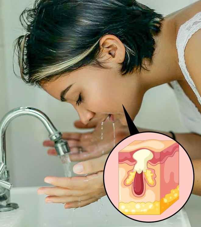 6 quan điểm chăm s&oacute;c da phổ biến nhưng lại sai lầm - Ảnh 5.