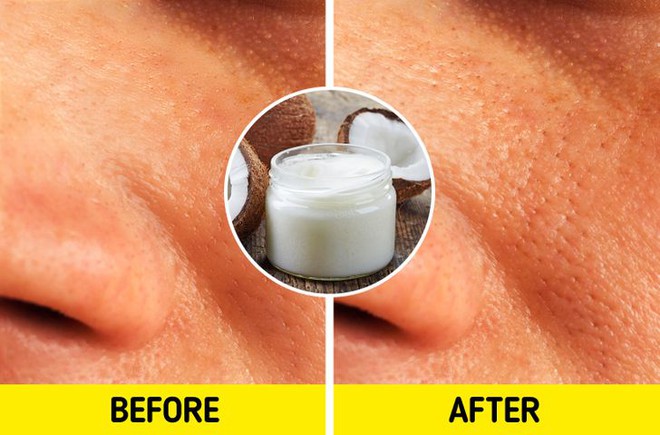 6 quan điểm chăm s&oacute;c da phổ biến nhưng lại sai lầm - Ảnh 4.