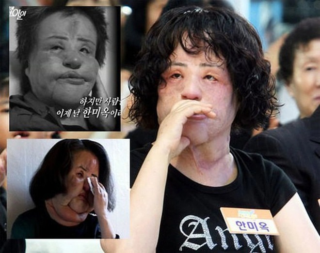Thảm họa thẩm mỹ xứ Hàn: Nữ ca sĩ 17 lần phẫu thuật cứu vãn nhan sắc vì tự tiêm dầu ăn và cái chết bí ẩn tuổi 57 - Ảnh 8.
