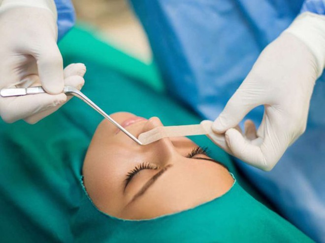 Sai lầm khi nâng mũi cao tây dễ gây lệch, thậm chí làm thủng đầu mũi - Ảnh 2.