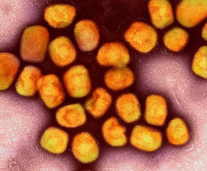 Virus đậu m&ugrave;a khỉ tấn c&ocirc;ng những bộ phận &iacute;t ai ngờ: Cần đề ph&ograve;ng biến chứng nặng - Ảnh 1.