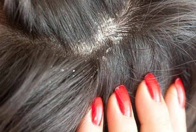 Những th&oacute;i quen g&acirc;y hư tổn t&oacute;c, bạn đ&atilde; biết chưa? - Ảnh 3.