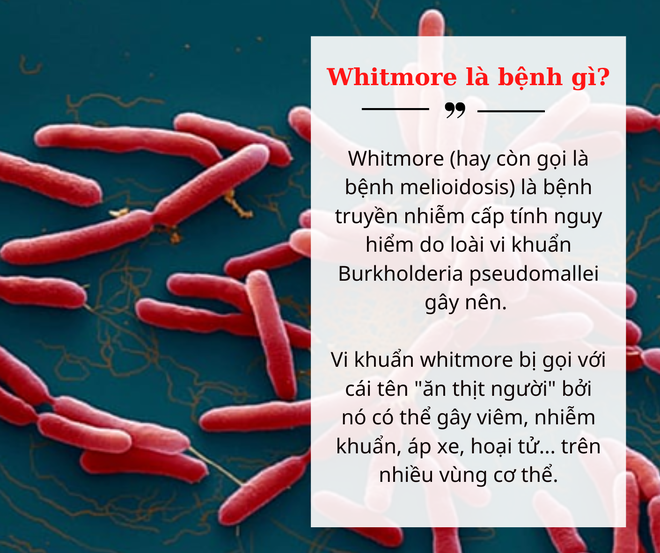 Bệnh nhi 15 tuổi tử vong vì nhiễm vi khuẩn gây bệnh Whitmore: Bệnh nguy hiểm như thế nào? - Ảnh 1.