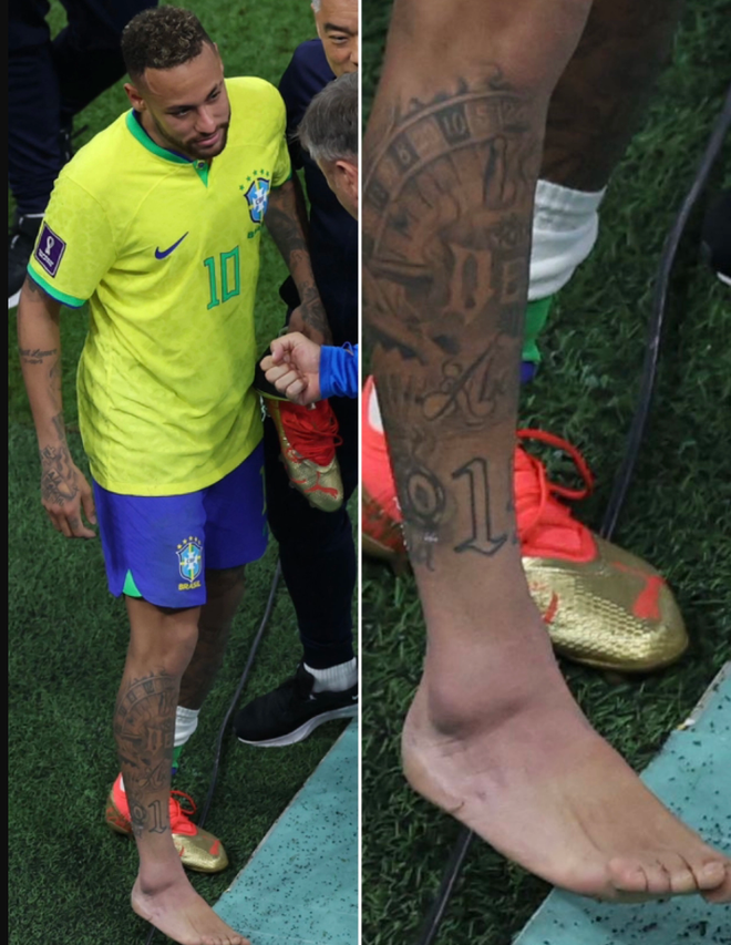 Để cứu Brazil, Neymar có thể tiêm giảm đau, mặc đồ bảo hộ ra sân - Ảnh 2.