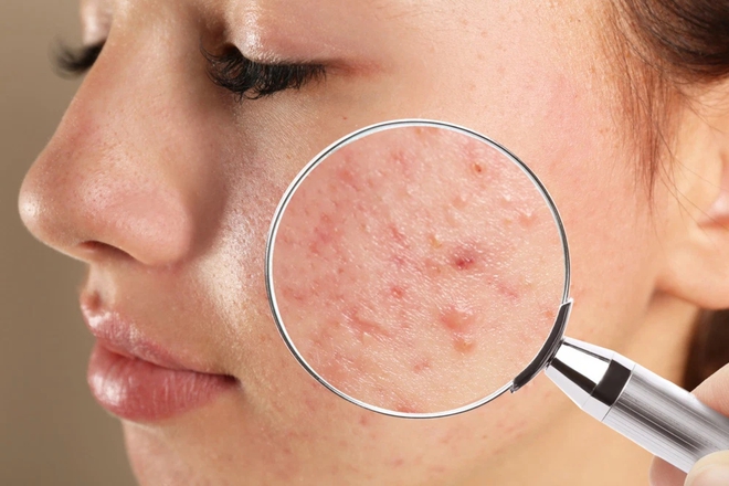 Chuy&ecirc;n gia chỉ ra những hậu quả nghi&ecirc;m trọng khi d&ugrave;ng mỹ phẩm k&eacute;m chất lượng - Ảnh 8.