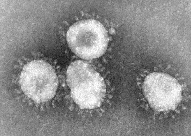 Các nhà khoa học đánh thức 13 loại virus thời tiền sử từ lớp băng vĩnh cửu ở Siberia - Ảnh 2.