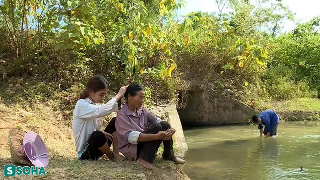 Bị chế nhạo l&agrave; người khỉ, c&ocirc; g&aacute;i cắn răng chịu đau, trải qua 5 cuộc đại phẫu mong đổi đời - Ảnh 1.