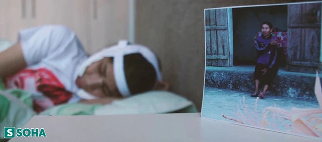 Bị chế nhạo l&agrave; người khỉ, c&ocirc; g&aacute;i cắn răng chịu đau, trải qua 5 cuộc đại phẫu mong đổi đời - Ảnh 4.