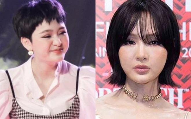 Thì ra đây là lý do Hiền Hồ cật lực tiêm filler và làm đủ c.ách để cải thiện nhan sắc? - Ảnh 3.