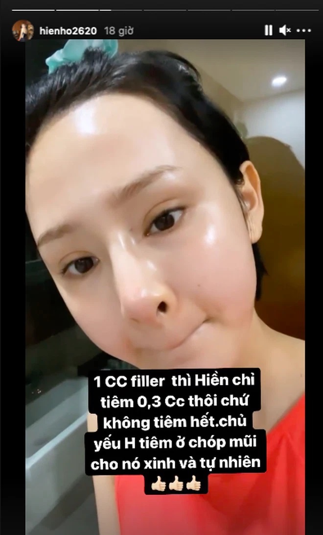 Thì ra đây là lý do Hiền Hồ cật lực tiêm filler và làm đủ c.ách để cải thiện nhan sắc? - Ảnh 2.